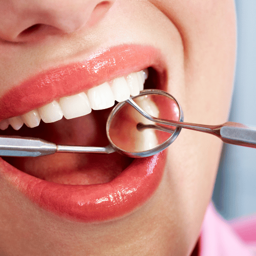 Dental Procedures