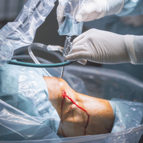 Orthopedic Surgeries